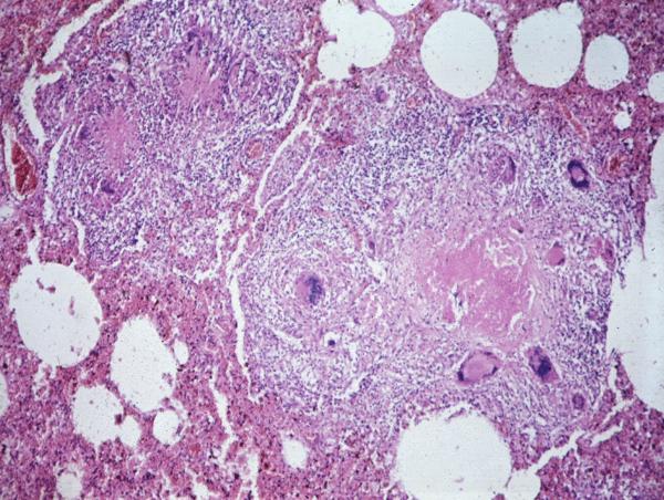 Histo Makro Pathologie Basic